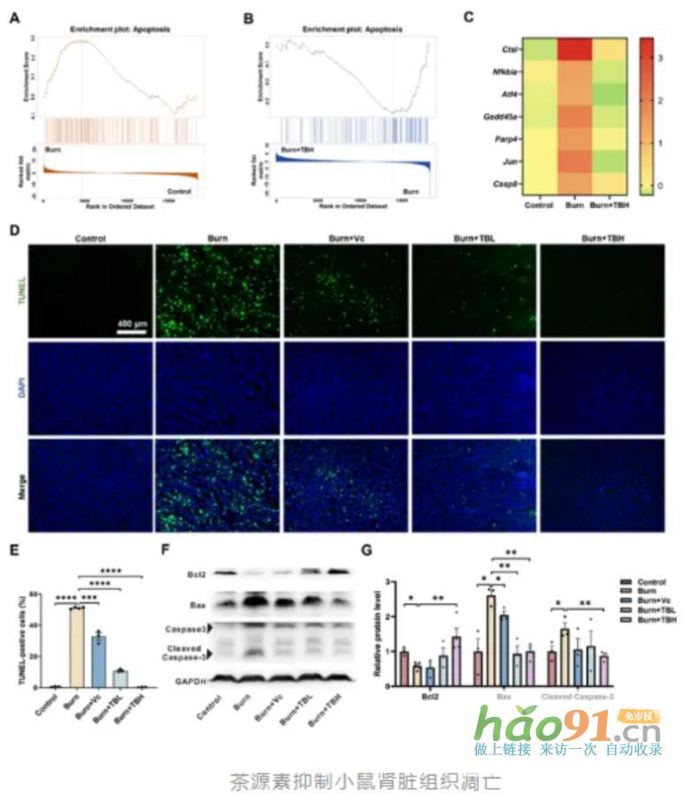 【科研速報】荷蓬茶源素通過代謝調(diào)控實現(xiàn)多維度腎臟保護